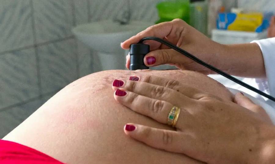 Saúde recomenda cálcio para todas as gestantes para prevenir eclâmpsia 1