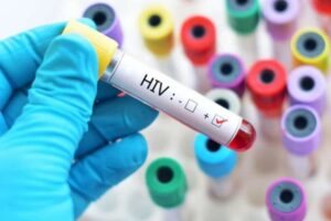 Anvisa aprova injeção semestral contra o HIV com quase 100% de eficácia 17